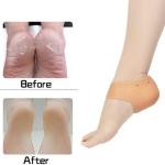 Heel Anti Crack Set